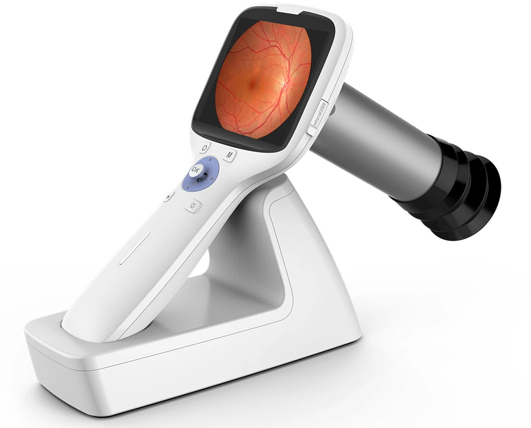 Hes-1000 Portable Handheld Non-Mydriatic Digital Fundus Retinal Camera