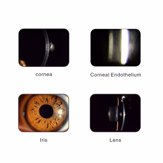 Lâmpada de fenda digital portátil para câmera oftálmica de alta qualidade